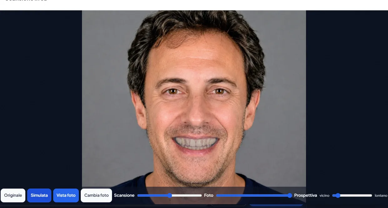 La Vista clinica di SmileLive: la scansione 3D dei denti sovrapposta alla foto del viso, con i comandi Scansione, Foto e Prospettiva